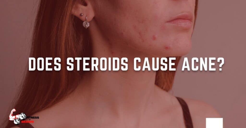 Does steroids cause acne? Expert Review Fitness and Brawn