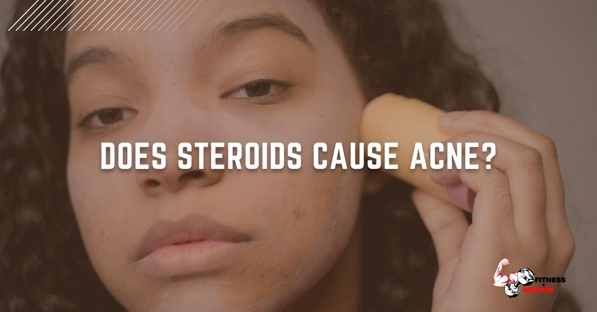 Does Steroids cause Acne?