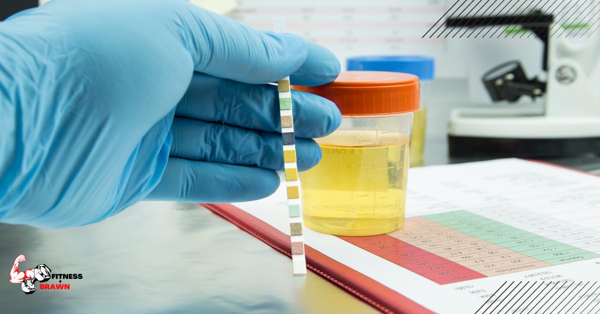 Does Winstrol Show Up in a Urine Test? Everything You Need to Know Fitness and Brawn
