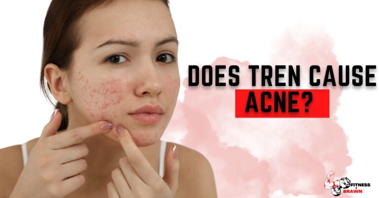 Does Tren cause Acne? (UPDATED)