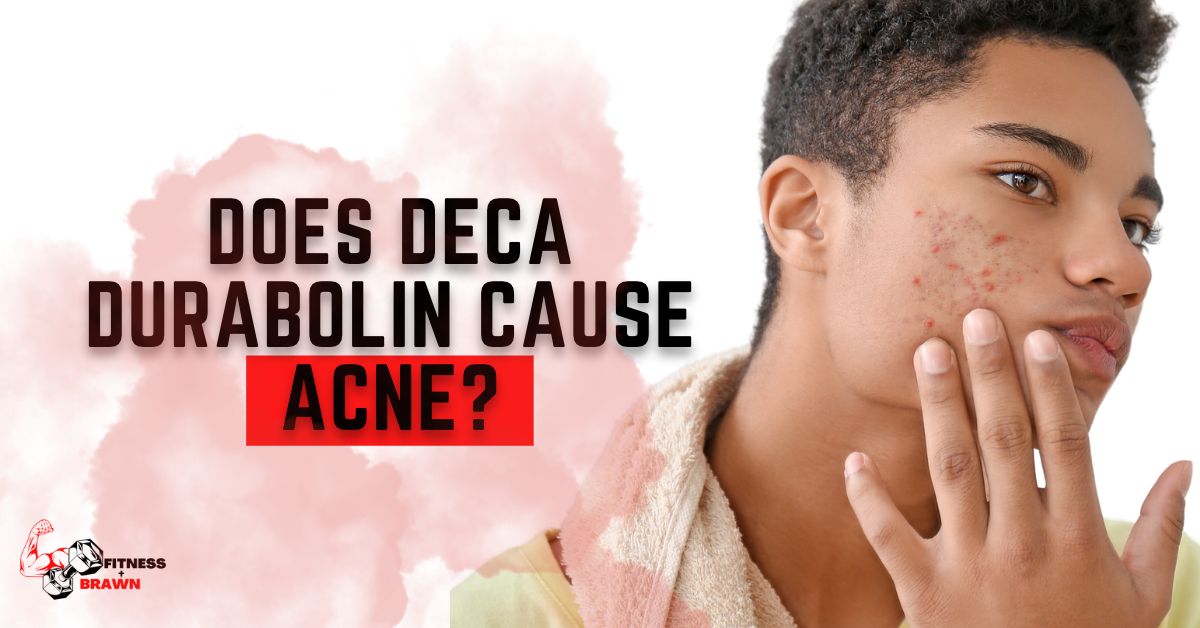 Does Deca Durabolin Cause Acne?