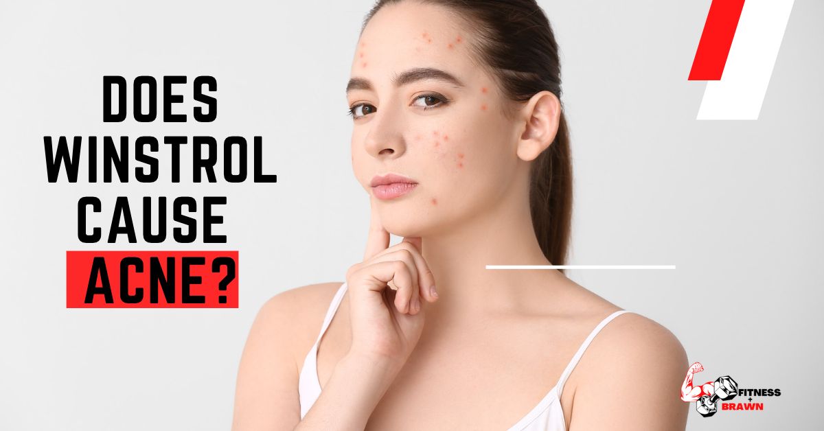 Does Winstrol Cause Acne?
