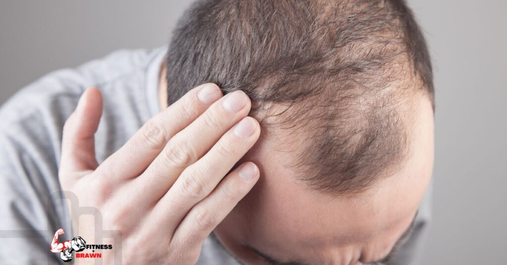 Tren and Hair loss 1024x536 - Does Trenbolone cause Hair Loss? Find Out