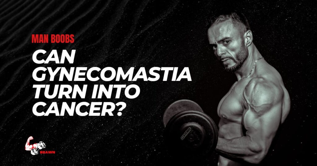 Can Gynecomastia Turn Into Cancer?